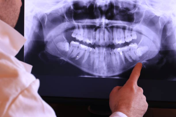 Best Urgent Care for Lost Fillings or Crowns in Phenix City, AL