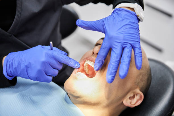 Best Emergency Tooth Extraction in Phenix City, AL